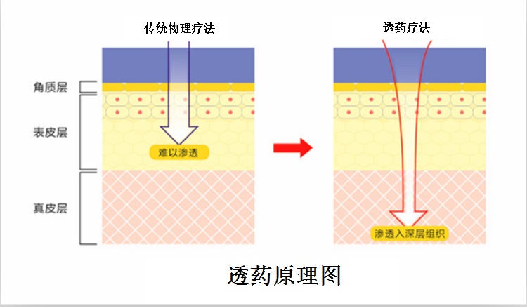 原理.jpg