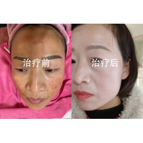 台湾细胞培植膜免费培训 广州南妆工厂